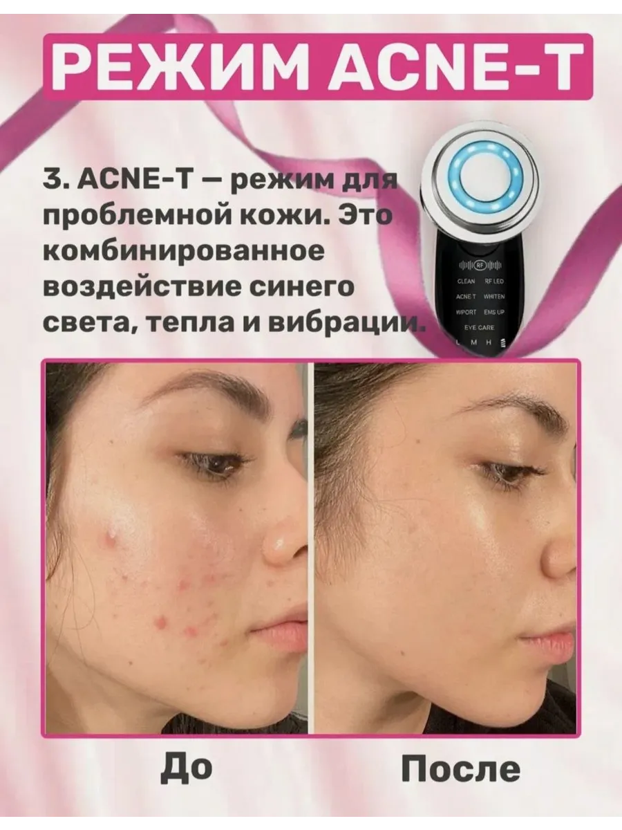 Микротоковый массажер для лица от морщин и отеков — фото 5
