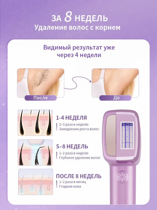 Фотоэпилятор MLAY T14 IPL лазерный эпилятор для удаления волос с охлаждением 3 сменных картриджа 1 500 000 вспышек, вариант, фото 7