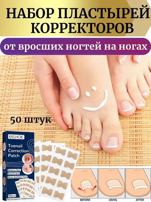 КЕВО От вросшего ногтя пластырь -корректор,от врастания на пальце, бежевый, фото 2