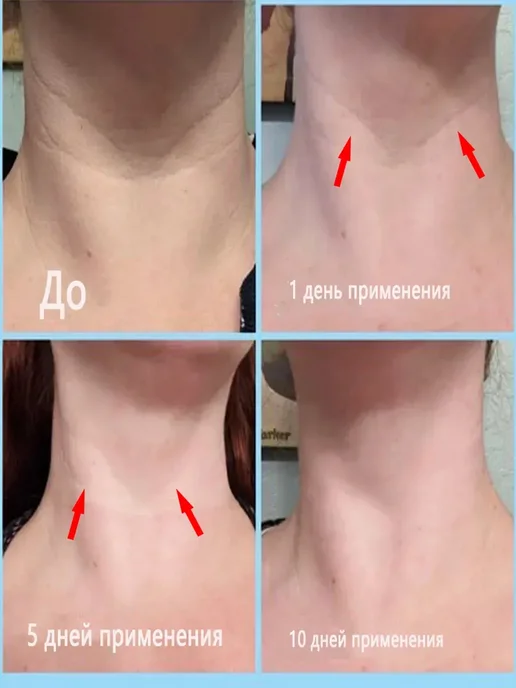 Антивозрастная маска для шеи, против морщин, 10 штук, вариант, фото 3