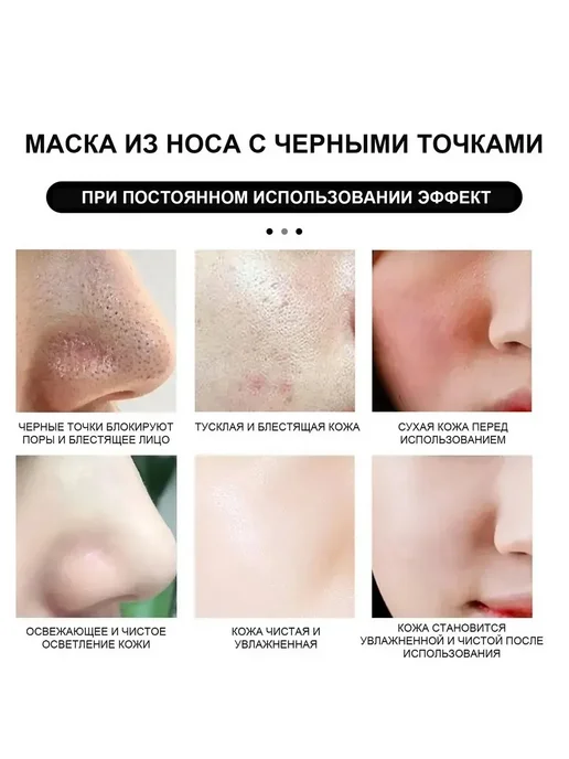 Грязевая маска для очищения носа против черных точек прыщей, черный, фото 3