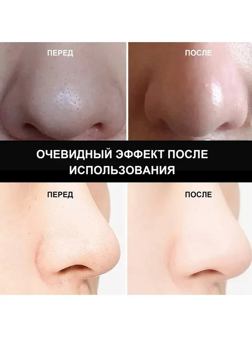 Грязевая маска для очищения носа против черных точек прыщей, черный, фото 5