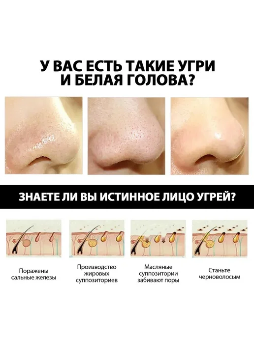 Бамбуковый уголь Удаление черных точек маска Уменьшить поры, черный, фото 2