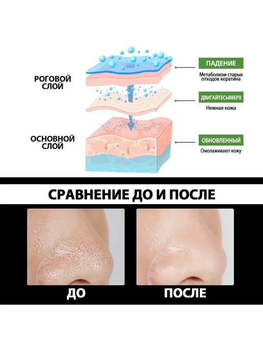 Бамбуковый уголь Удаление черных точек маска Уменьшить поры, черный, фото 3