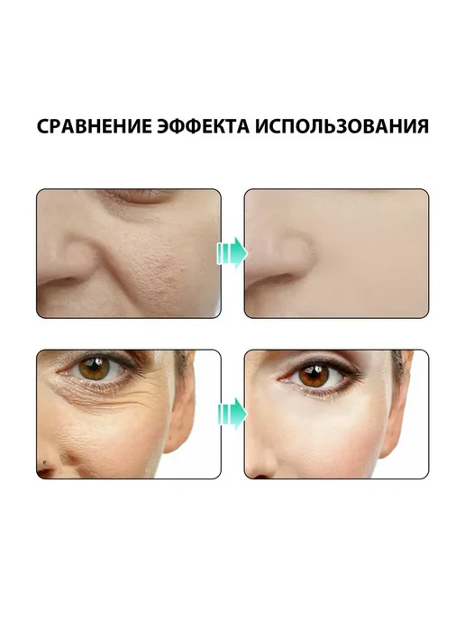 Антивозрастное массажное масло для лица разглаживание морщин, 30 мл, фото 5