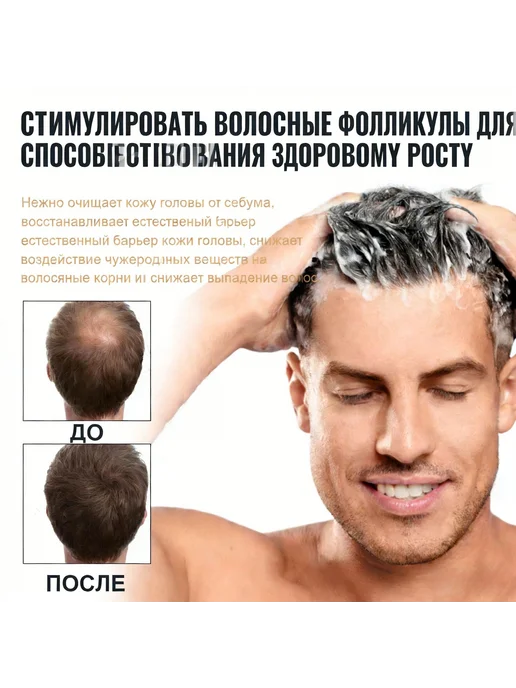 Нет бренда Шампунь против выпадения, для густоты и объема, вариант, фото 6