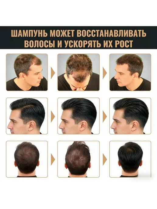 Нет бренда Шампунь против выпадения, для густоты и объема, вариант, фото 7
