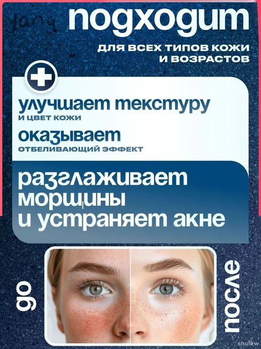 Термальная вода, вариант, фото 5
