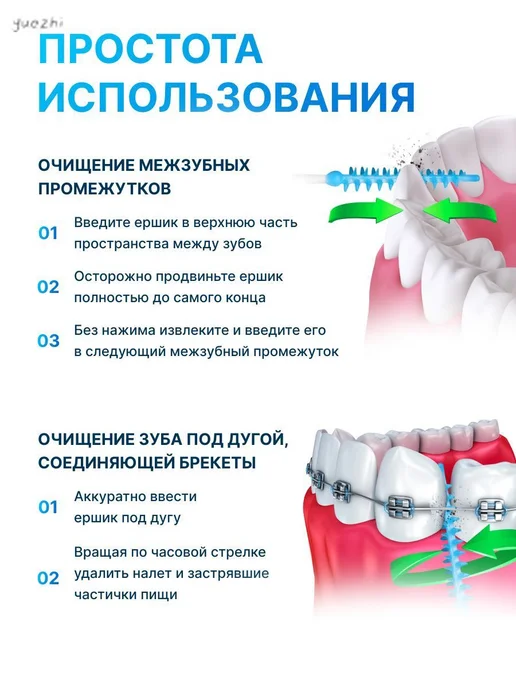 Межзубный ершик, вариант, фото 5