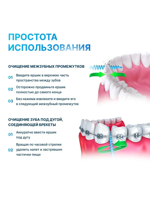 Ершики для зубов брекетов межзубные 40 шт, 40 шт, фото 2