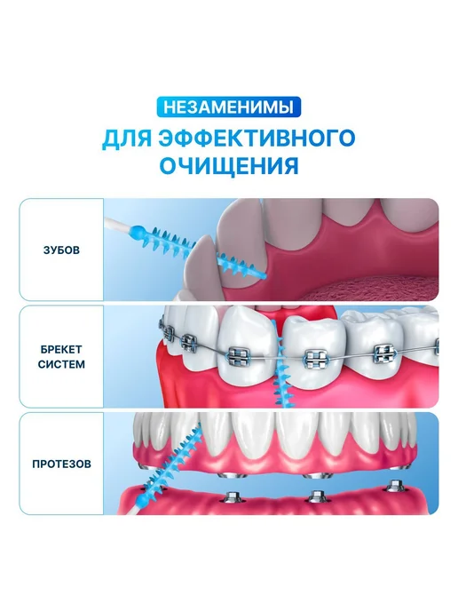 Ершики для зубов брекетов межзубные 40 шт, 40 шт, фото 4