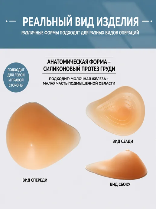 Силиконовый экзопротез груди левосторонний после мастэктомии, бежевый, фото 3