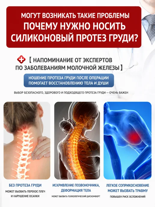 Силиконовый экзопротез груди левосторонний после мастэктомии, бежевый, фото 6