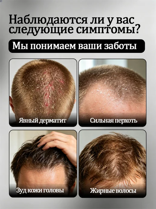 Мужской шампунь от перхоти и жирности кожи головы, вариант, фото 2