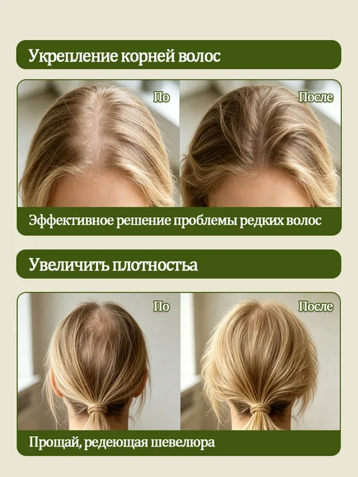 Шампунь для роста волос с биотин против выпадения, вариант, фото 4