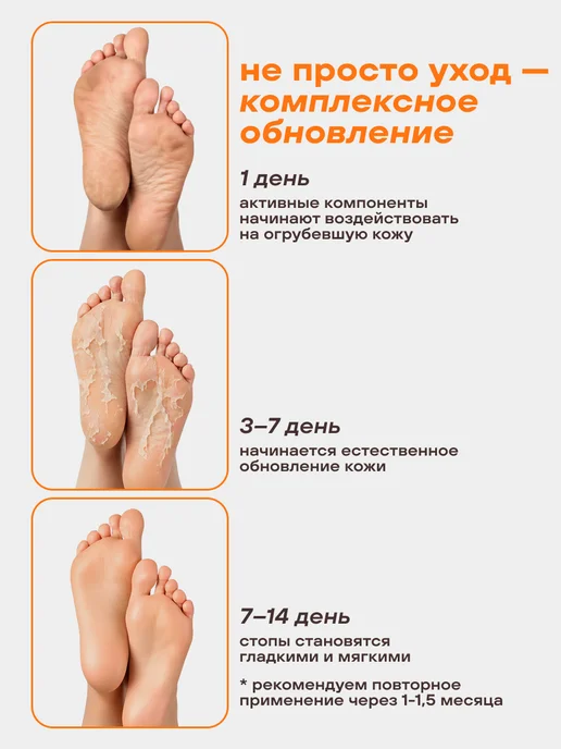 FOXY EXPERT Пилинг носочки педикюрные для ног, маска отшелушивающая 1 шт, 1 шт, фото 8