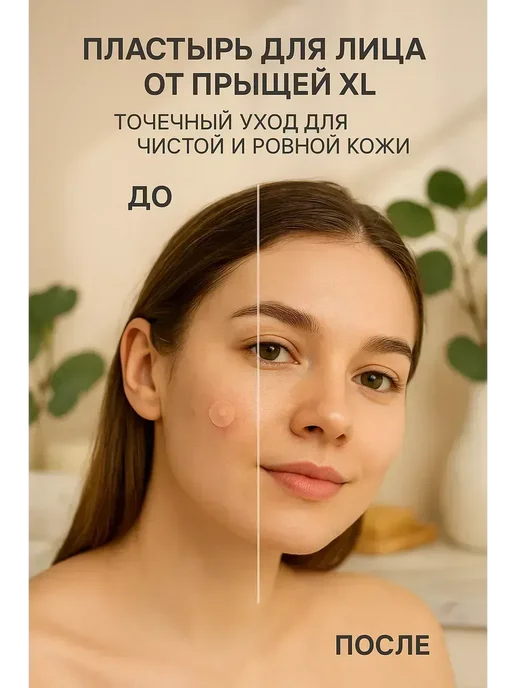RKCH ( Пластырь для лица от прыщей XL точечный уход 96 шт*, 96 шт, фото 4