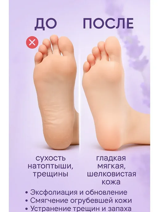 Alexaint Пилинг носочки для ног педикюрные отшелушивающие*, белый, фото 3