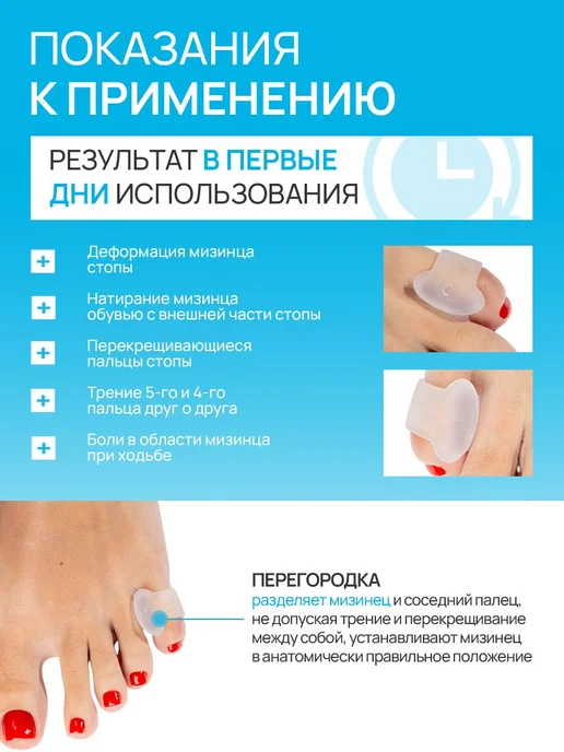 Вилка для отделения пальцев от мизинца, 2 шт, белая, 2 шт, фото 4