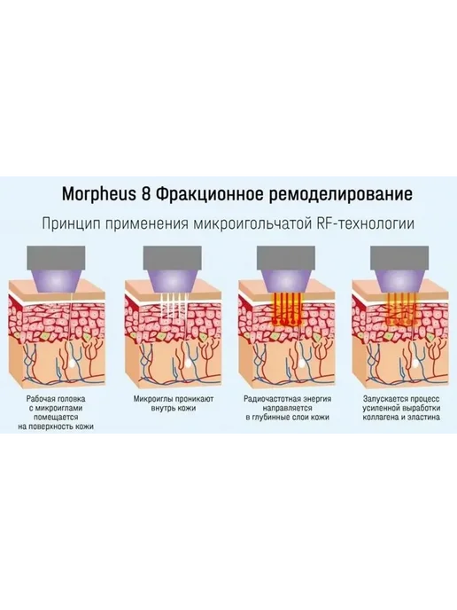 Насадка 24 игл для аппарата микроигольчатого RF-лифтинга, вариант, фото 3