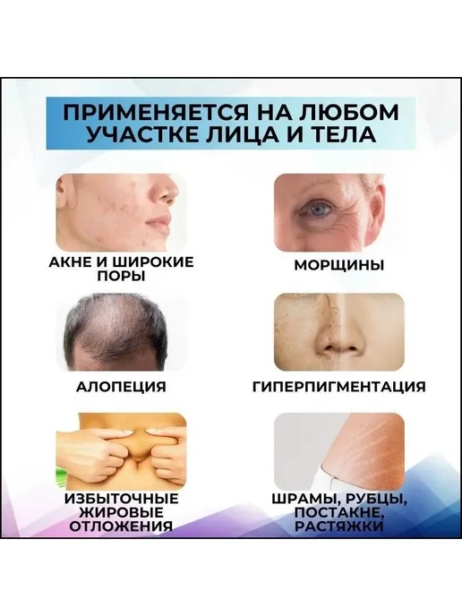 Картридж Винт для дермапена, 36 игл, 10 шт, 10 шт, фото 3